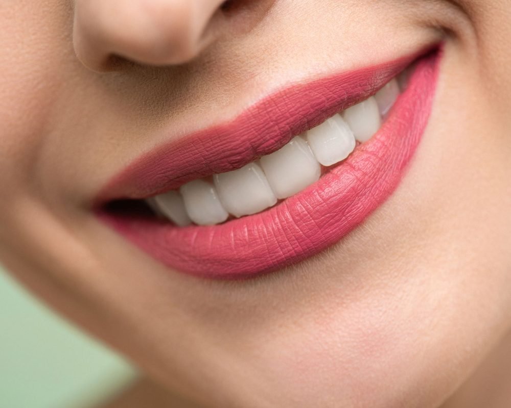 Close-up of a bright white smile