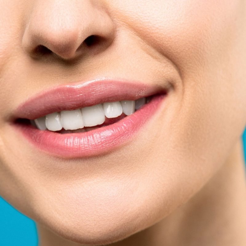 Healthy smile
