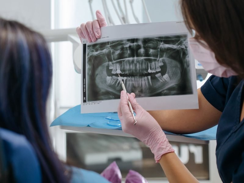 Dentist showing an X-ray to a patient