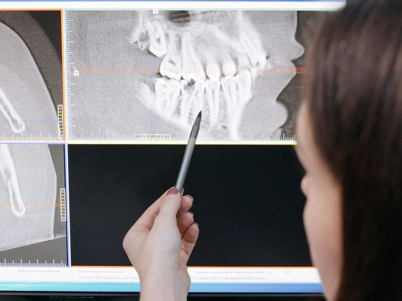 Dentist reviewing digital scans