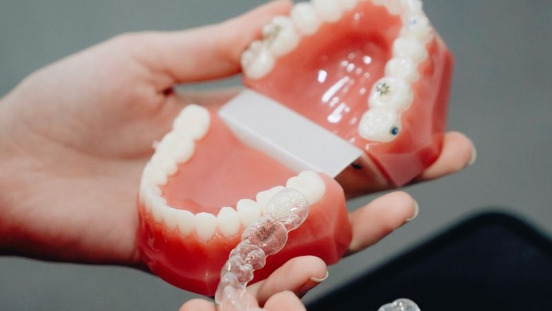 Clear aligner and dental model